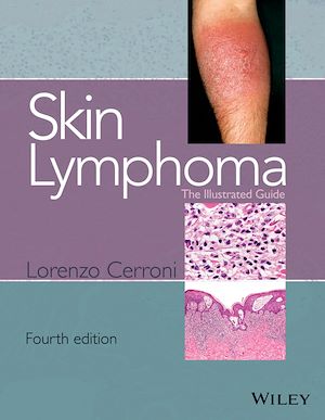 Téléchargez le livre :  Skin Lymphoma