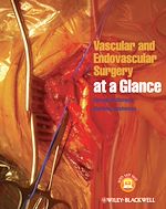 Télécharger le livre :  Vascular and Endovascular Surgery at a Glance