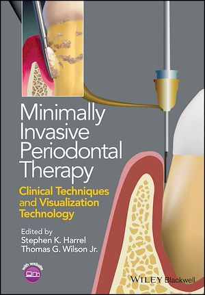 Download the eBook: Minimally Invasive Periodontal Therapy