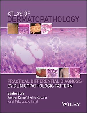Download the eBook: Atlas of Dermatopathology