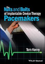 Download this eBook The Nuts and Bolts of Implantable Device Therapy