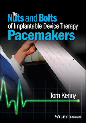 Download the eBook: The Nuts and Bolts of Implantable Device Therapy