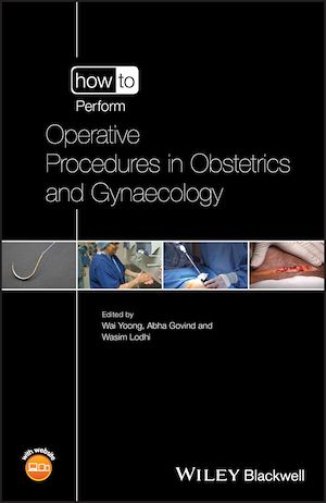Download the eBook: How to Perform Operative Procedures in Obstetrics and Gynaecology