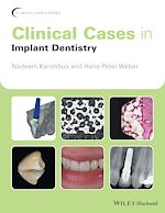 Télécharger le livre :  Clinical Cases in Implant Dentistry