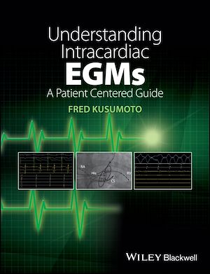 Download the eBook: Understanding Intracardiac EGMs