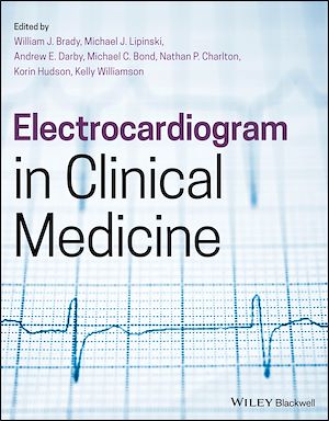 Download the eBook: Electrocardiogram in Clinical Medicine