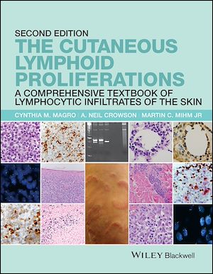 Download the eBook: The Cutaneous Lymphoid Proliferations