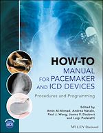 Download this eBook How-to Manual for Pacemaker and ICD Devices