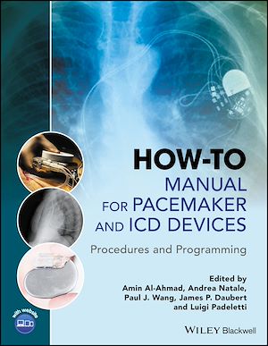 Download the eBook: How-to Manual for Pacemaker and ICD Devices