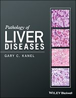 Download this eBook Pathology of Liver Diseases
