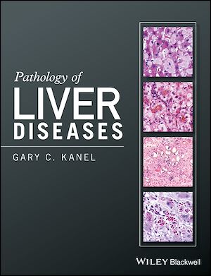 Download the eBook: Pathology of Liver Diseases