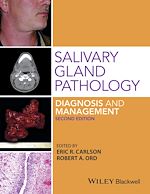 Télécharger le livre :  Salivary Gland Pathology