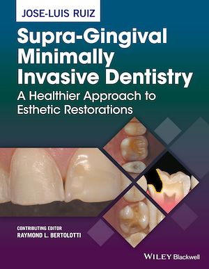 Download the eBook: Supra-Gingival Minimally Invasive Dentistry