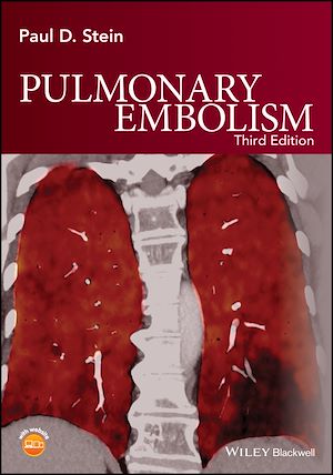 Download the eBook: Pulmonary Embolism