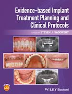 Download this eBook Evidence-based Implant Treatment Planning and Clinical Protocols