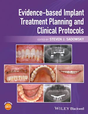 Download the eBook: Evidence-based Implant Treatment Planning and Clinical Protocols