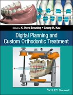 Télécharger le livre :  Digital Planning and Custom Orthodontic Treatment