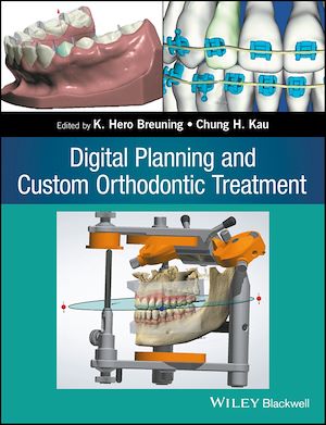 Téléchargez le livre :  Digital Planning and Custom Orthodontic Treatment