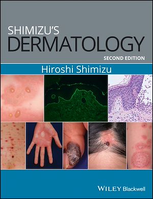 Download the eBook: Shimizu's Dermatology