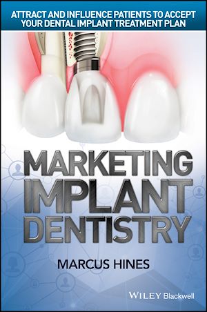 Download the eBook: Marketing Implant Dentistry