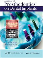 Download this eBook Journal of Prosthodontics on Dental Implants
