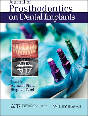 Download the eBook: Journal of Prosthodontics on Dental Implants