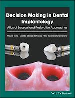 Télécharger le livre :  Decision Making in Dental Implantology