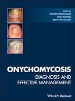 Télécharger le livre :  Onychomycosis