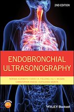 Download this eBook Endobronchial Ultrasonography