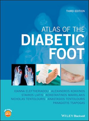 Download the eBook: Atlas of the Diabetic Foot
