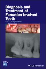 Télécharger le livre :  Diagnosis and Treatment of Furcation-Involved Teeth