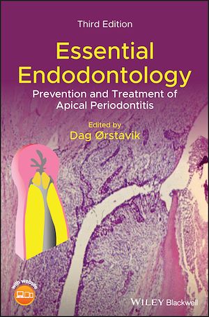 Download the eBook: Essential Endodontology