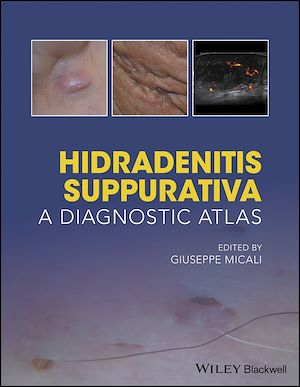 Téléchargez le livre :  Hidradenitis Suppurativa