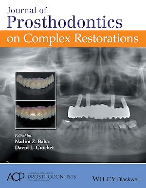 Download the eBook: Journal of Prosthodontics on Complex Restorations