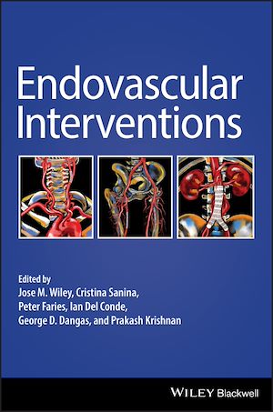 Download the eBook: Endovascular Interventions