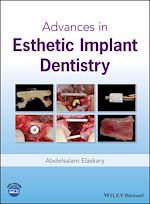 Download this eBook Advances in Esthetic Implant Dentistry