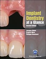Télécharger le livre :  Implant Dentistry at a Glance