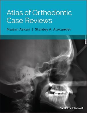 Téléchargez le livre :  Atlas of Orthodontic Case Reviews