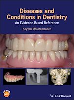 Télécharger le livre :  Diseases and Conditions in Dentistry