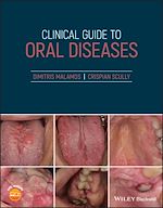 Télécharger le livre :  Clinical Guide to Oral Diseases