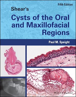 Téléchargez le livre :  Shear's Cysts of the Oral and Maxillofacial Regions