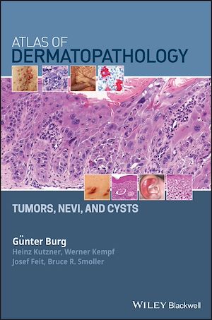Download the eBook: Atlas of Dermatopathology