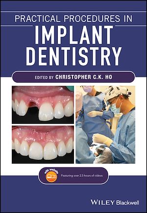 Téléchargez le livre :  Practical Procedures in Implant Dentistry