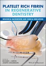 Download this eBook Platelet Rich Fibrin in Regenerative Dentistry