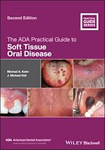 Télécharger le livre :  The ADA Practical Guide to Soft Tissue Oral Disease