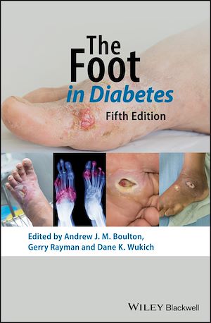 Download the eBook: The Foot in Diabetes