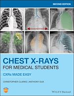 Télécharger le livre :  Chest X-Rays for Medical Students