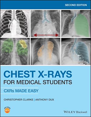 Téléchargez le livre :  Chest X-Rays for Medical Students