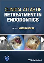 Télécharger le livre :  Clinical Atlas of Retreatment in Endodontics