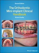 Télécharger le livre :  The Orthodontic Mini-implant Clinical Handbook
